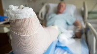 Broken Bones